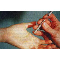 ACS Acupuncture Sujok Needle - (18x7mm) Pkt. of 50 