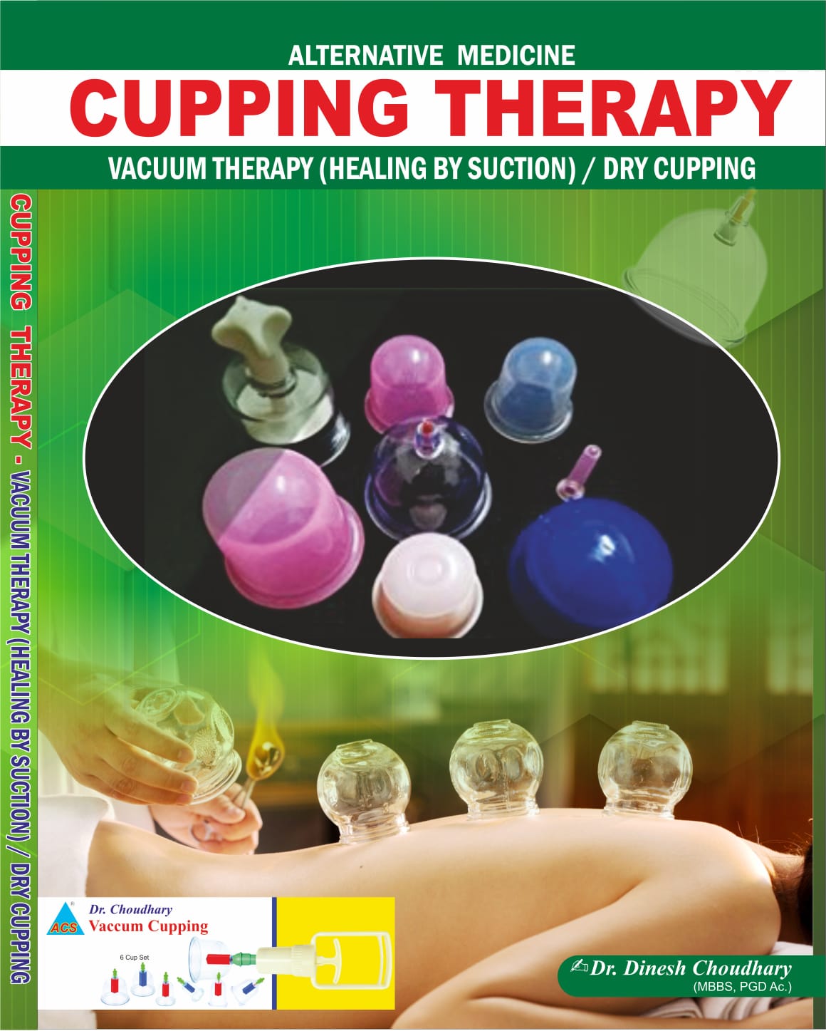 ACS Cupping (Hijama/Vacuum )Therapy -Dr.Dinesh Choudhary Book -English - 310 