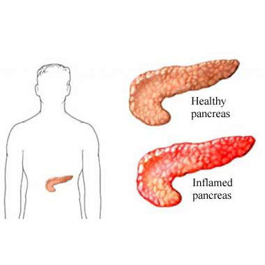 Pancreas  -  